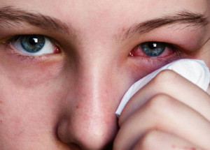 saiba-como-se-prevenir-de-conjuntivite-no-verao-correio-nogueirense