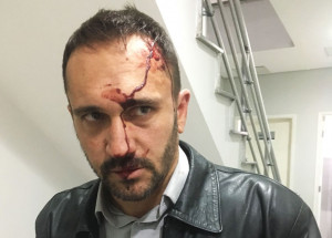 vereador-rodrigo-de-faveri-e-agredido-na-camara-correio-nogueirense