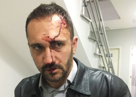 vereador-rodrigo-de-faveri-e-agredido-na-camara-correio-nogueirense