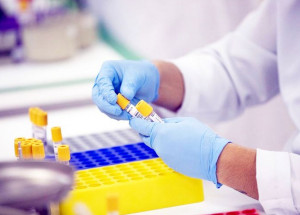 estudo-revela-compostos-que-podem-combater-um-tipo-de-tuberculose-correio-nogueirense