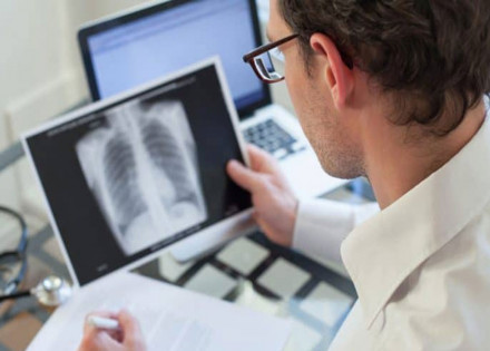 ministro-anuncia-medicacao-simplificada-para-combate-a-tuberculose-correio-nogueirense