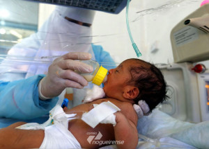 unicef-1-a-cada-3-criancas-menores-de-5-anos-nao-cresce-adequadamente-correio-nogueirense