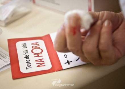 ministerio-da-saude-135-mil-convivem-com-hiv-no-pais-e-nao-sabem-correio-nogueirense