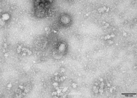 governo-cria-grupo-para-monitorar-casos-de-coronavirus-correio-nogueirense