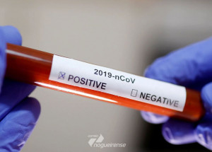 ministerio-da-saude-confirma-segundo-caso-de-coronavirus-no-brasil-correio-nogueirense
