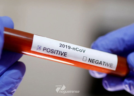 ministerio-da-saude-confirma-segundo-caso-de-coronavirus-no-brasil-correio-nogueirense