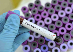 saude-de-itatiba-divulga-orientacoes-sobre-coronavirus-para-funcionarios-correio-nogueirense