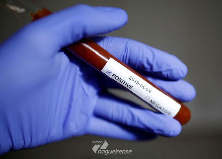 coronavirus-ira-abre-valas-comuns-correio-nogueirense