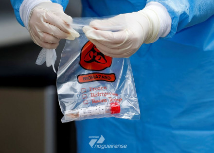 covid-19-500-mil-kits-de-teste-rapido-chegam-ao-brasil-correio-nogueirense