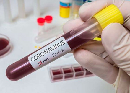 no-brasil-25-pessoas-morreram-em-decorrencia-do-novo-coronavirus-correio-nogueirense