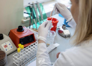 numero-de-casos-do-novo-coronavirus-chega-a-13-no-brasil-correio-nogueirense