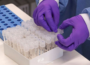 saiba-tudo-sobre-o-novo-coronavirus-e-a-doenca-que-ele-provoca-correio-nogueirense