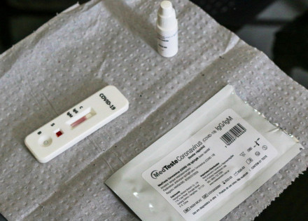anvisa-aprova-testes-rapidos-para-covid-19-em-farmacias-correio-nogueirense