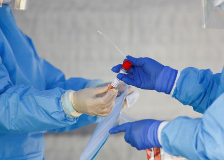 covid-19-brasil-tem-78-162-casos-44-dos-pacientes-estao-curados-correio-nogueirense