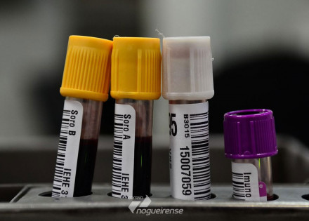 hemorio-inicia-testes-com-plasma-sanguineo-no-tratamento-de-covid-19-correio-nogueirense