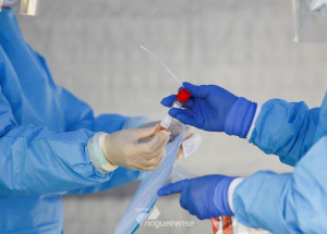 instituto-desenvolve-teste-rapido-para-detectar-covid-19-correio-nogueirense
