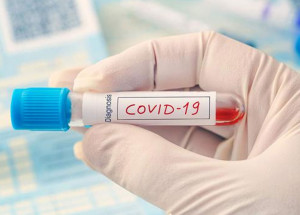 covid-19-brasil-tem-102-mil-novos-casos-atualizados-em-24h-correio-nogueirense