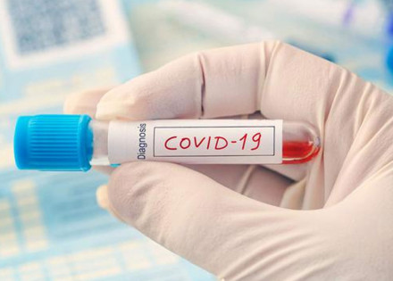 covid-19-brasil-tem-102-mil-novos-casos-atualizados-em-24h-correio-nogueirense