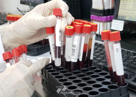 indaiatuba-realiza-sorologia-que-detecta-anticorpos-para-a-covid-19-correio-nogueirense