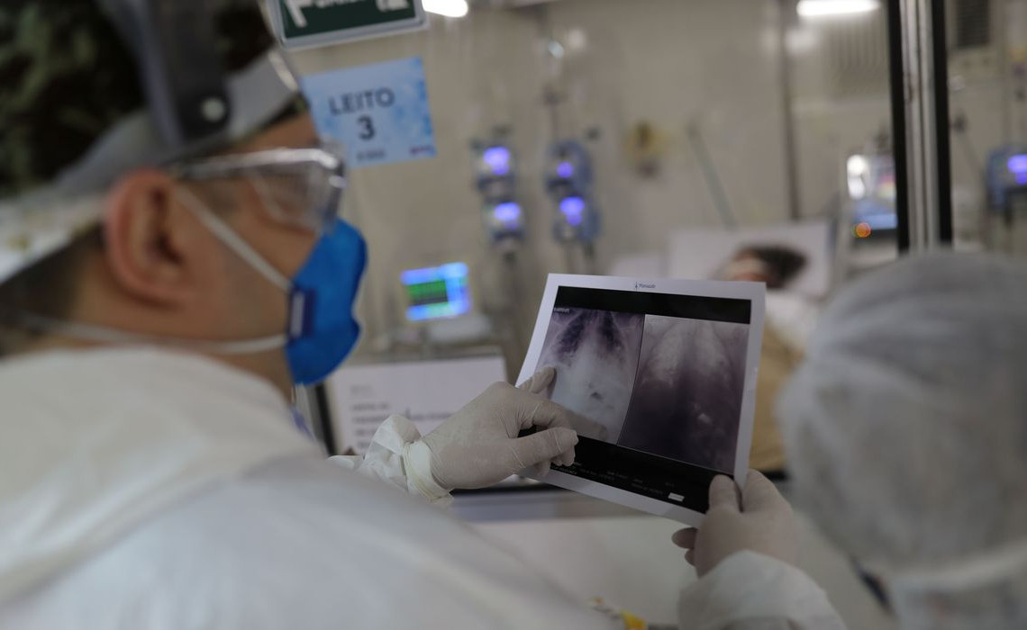 _radiografia_de_torax_coronaviruscovid-19_hospital_sao_paulo1205200326 (1)