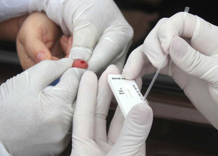 covid-19-resultados-de-testes-irao-para-o-ministerio-da-saude-correio-nogueirense