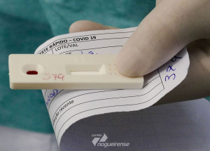 estado-de-sp-passa-de-416-mil-casos-confirmados-do-novo-coronavirus-correio-nogueirense