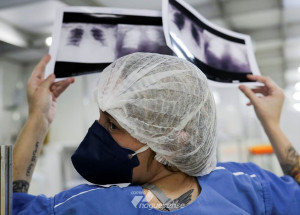 universidades-desenvolvem-apoio-a-diagnostico-de-covid-19-com-raio-x-correio-nogueirense