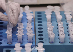 reinfeccoes-pelo-novo-coronavirus-criam-duvidas-sobre-imunidade-correio-nogueirense