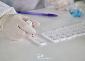 estado-de-sp-confirma-o-1o-caso-de-reinfeccao-por-covid-19-correio-nogueirense