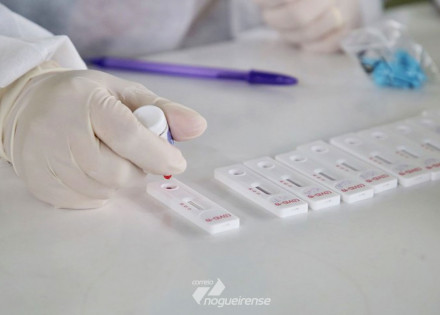 estado-de-sp-confirma-o-1o-caso-de-reinfeccao-por-covid-19-correio-nogueirense