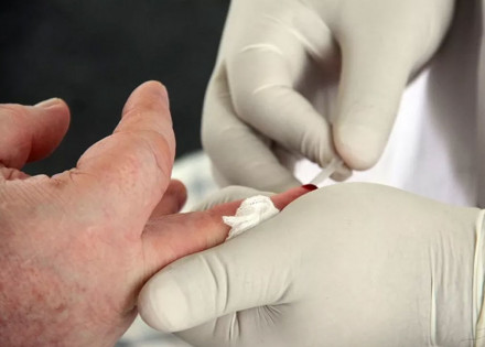 holambra-promove-testes-gratuitos-de-doencas-sexualmente-transmissiveis-correio-nogueirense