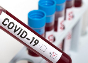 Covid-artur-nogueira