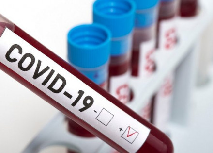 Covid-artur-nogueira