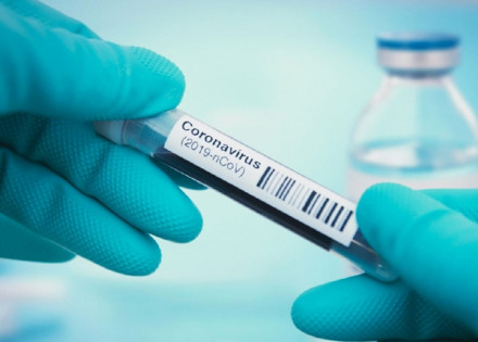 artur-nogueira-registra-mais-uma-morte-e-22-novos-casos-positivos-de-covid-19-correio-nogueirense