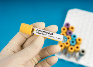 artur-nogueira-ultrapassa-4-mil-casos-de-covid-19-desde-o-inicio-da-pandemia-correio-nogueirense