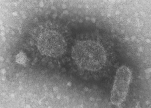 maioria-das-doencas-infecciosas-tem-origem-em-animais-selvagens-correio-nogueirense