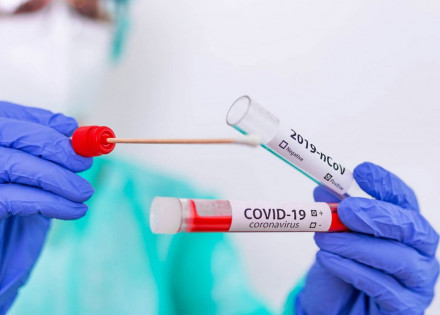 artur-nogueira-confirma-mais-14-casos-positivos-de-covid-19-nesta-quarta-correio-nogueirense