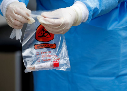 teste_coronavirus2603200043