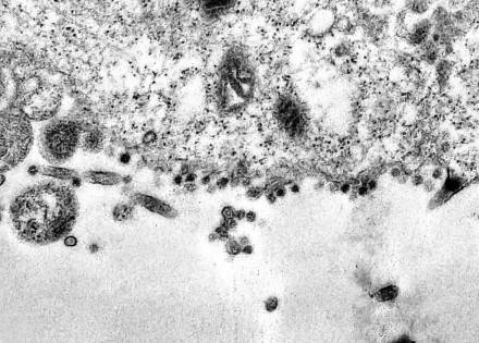 fiocruz_20200403_debora_barreto_00001