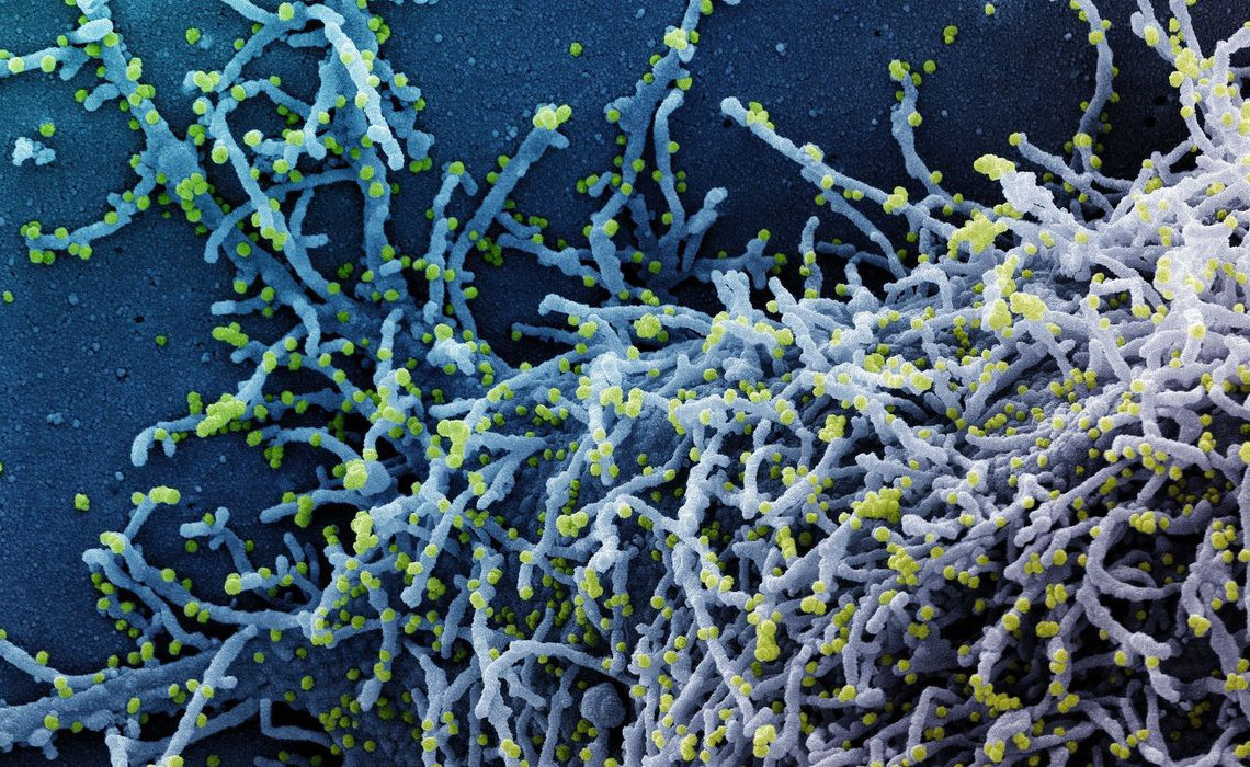 novo_coronavirus_sars-cov-2270920214120
