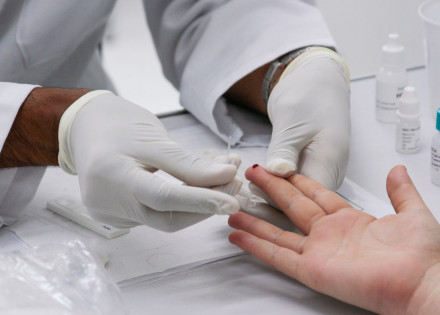 TESTE HIV