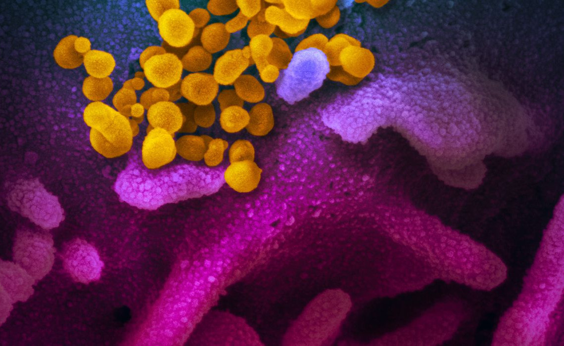 Coronavírus (COVID-19), Novo Coronavirus SARS-CoV-2