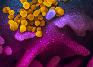 Coronavírus (COVID-19), Novo Coronavirus SARS-CoV-2