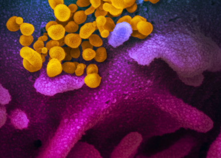 Coronavírus (COVID-19), Novo Coronavirus SARS-CoV-2