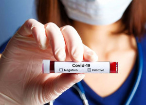 artur-nogueira-confirma-mais-13-casos-de-coronavirus-correio-nogueirense