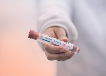 Conheça-a-importância-do-teste-rápido-para-Covid-19-para-ajudar-a-deter-a-pandemia-blog