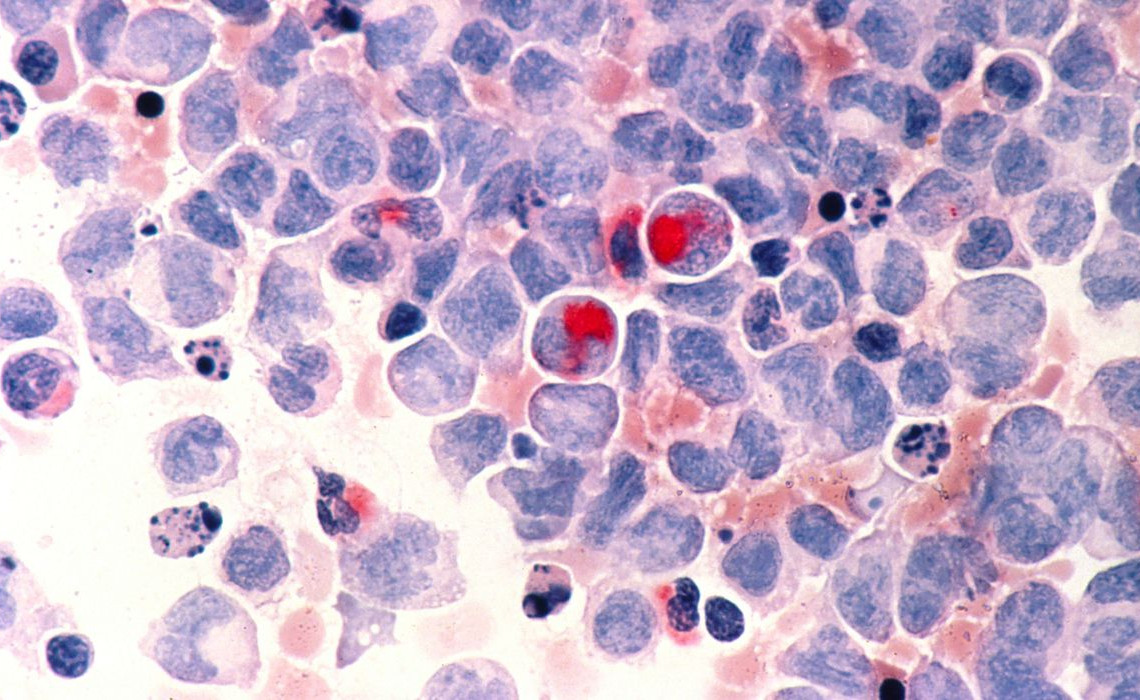 nci-vol-2336-300