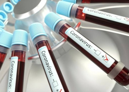 WhatsApp Image 2022-03-06 at 10.01.50