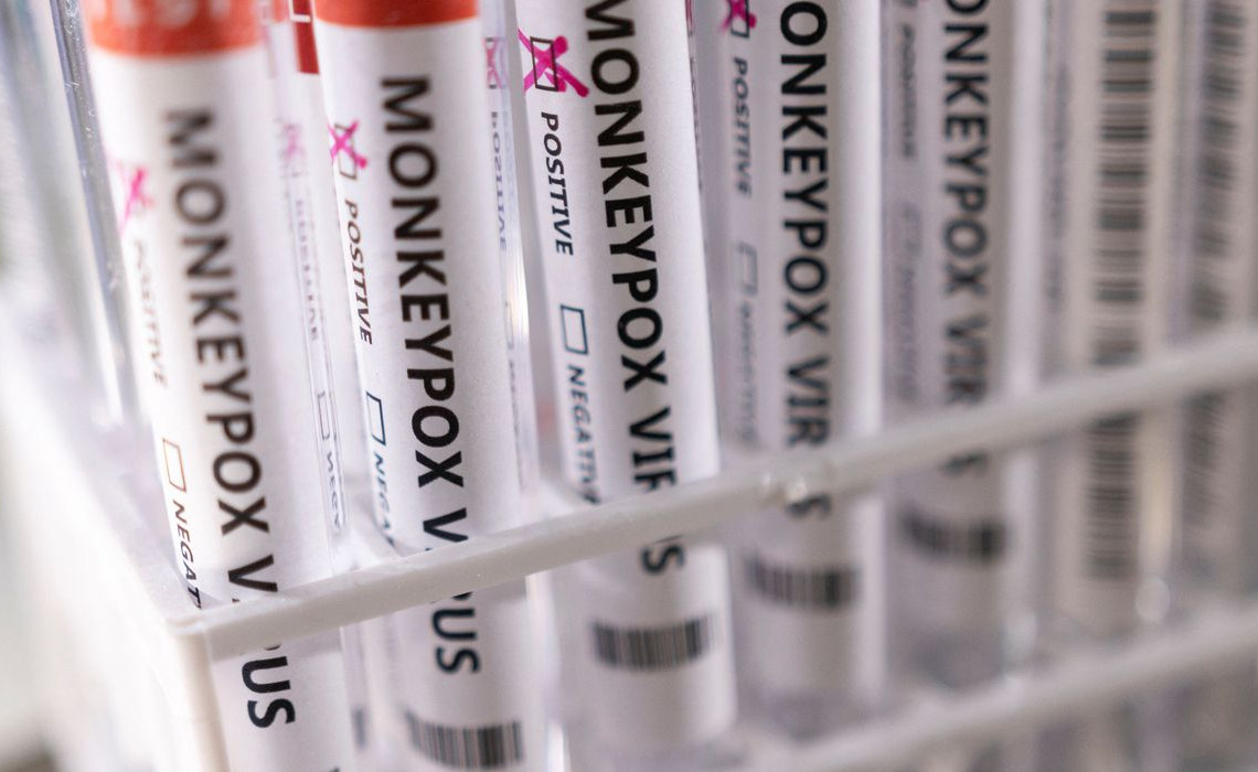 2022-05-23t222423z_1_lynxnpei4m100_rtroptp_4_health-monkeypox_1