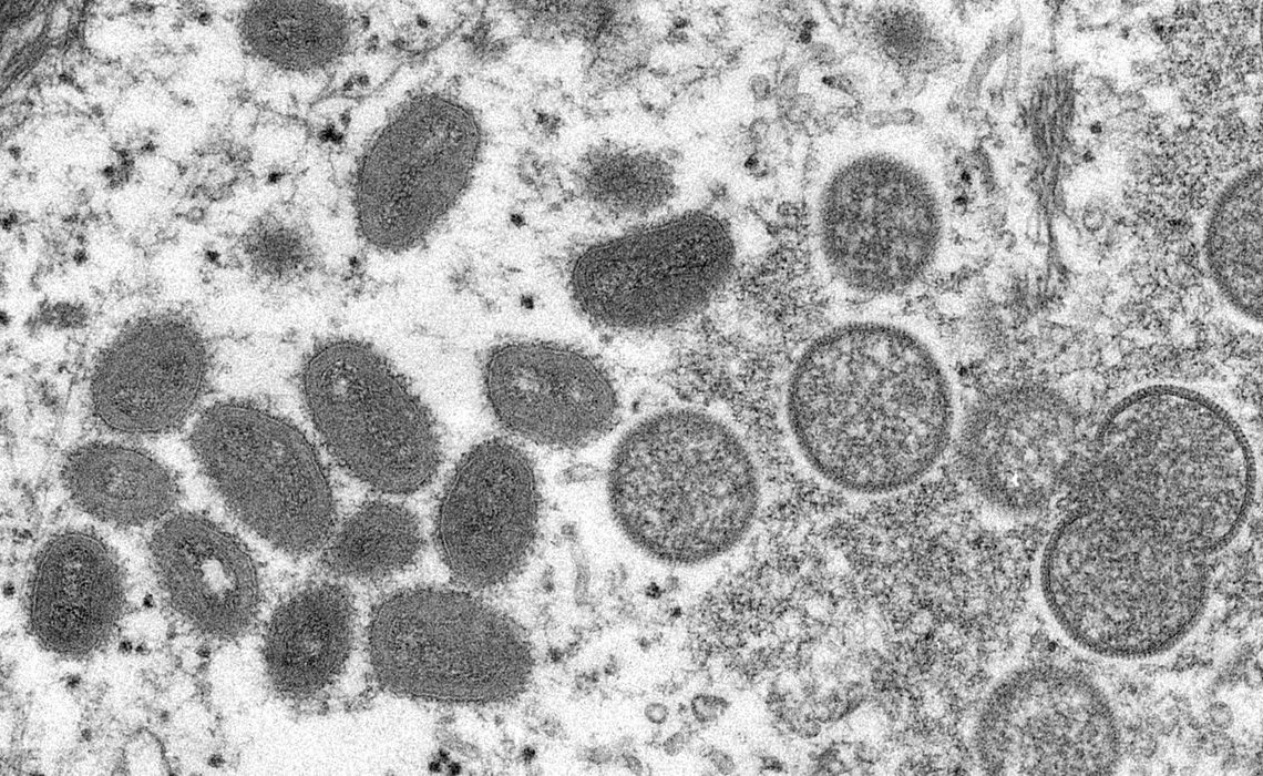2022-05-19t105043z_1152629469_rc2t9u9tzxd0_rtrmadp_3_health-monkeypox-portugal-spain (1)
